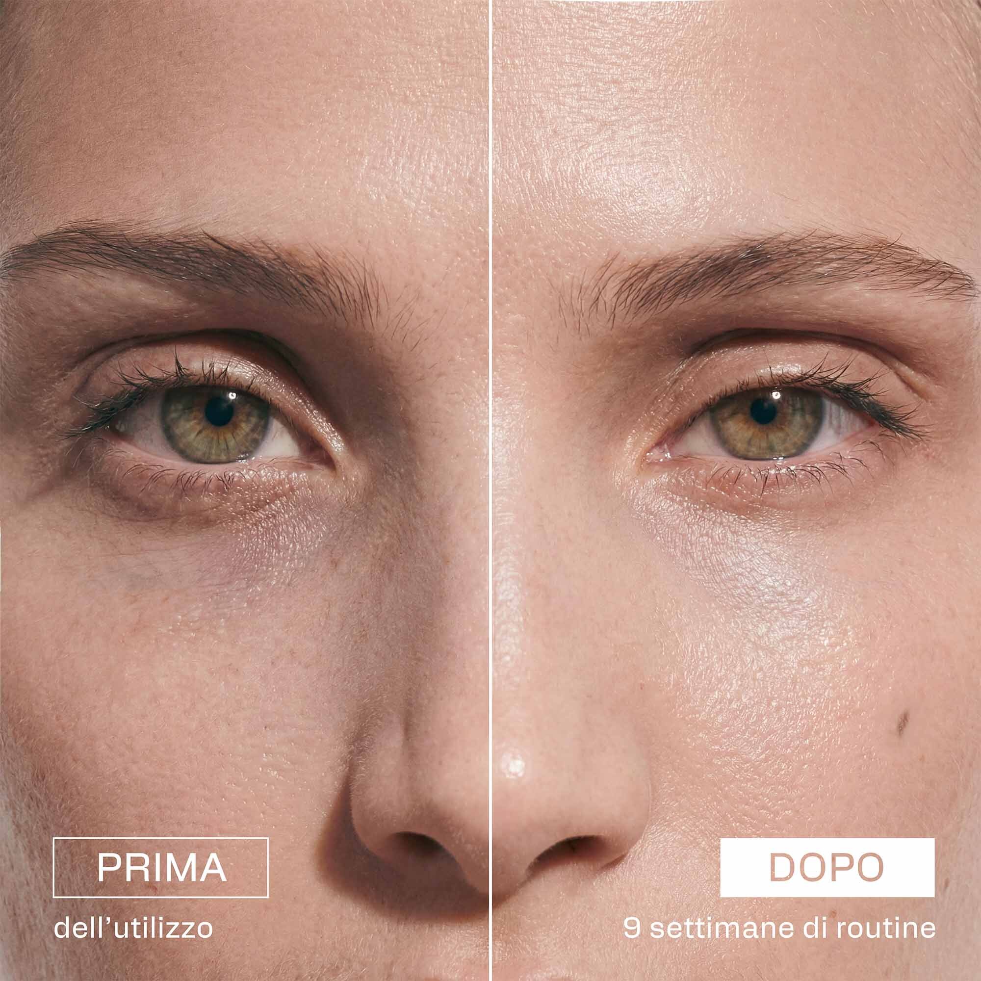 Confronto prima e dopo del trattamento ANTIOX ADVANCE