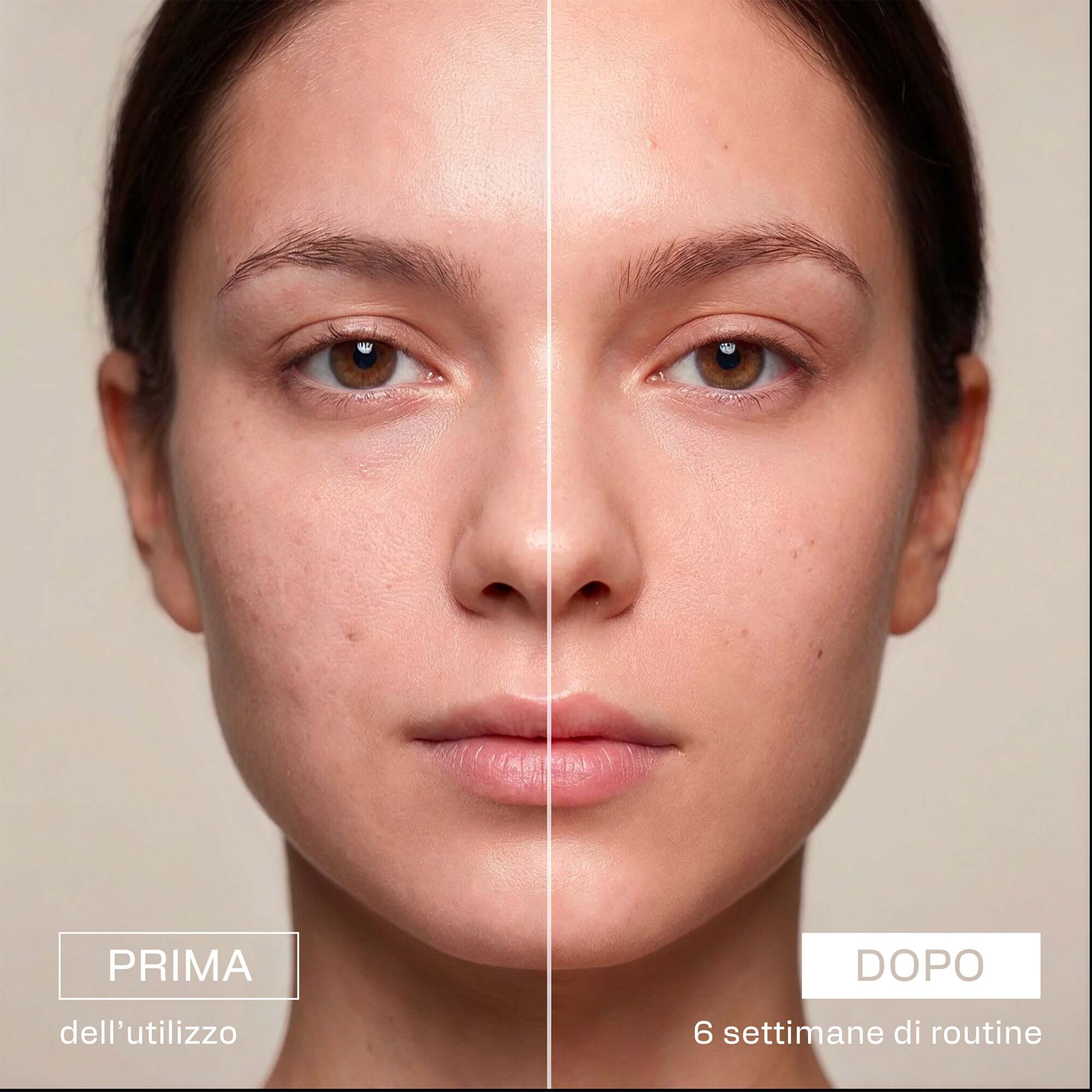 Confronto prima e dopo del trattamento BIOVITA C